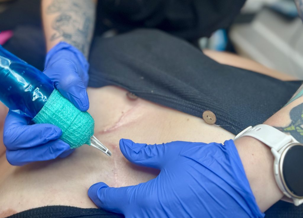 close up of the skin renewal service