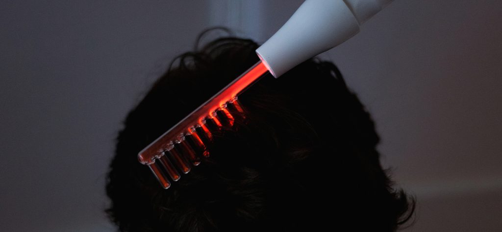 Hair loss services in Omaha at The Standard
